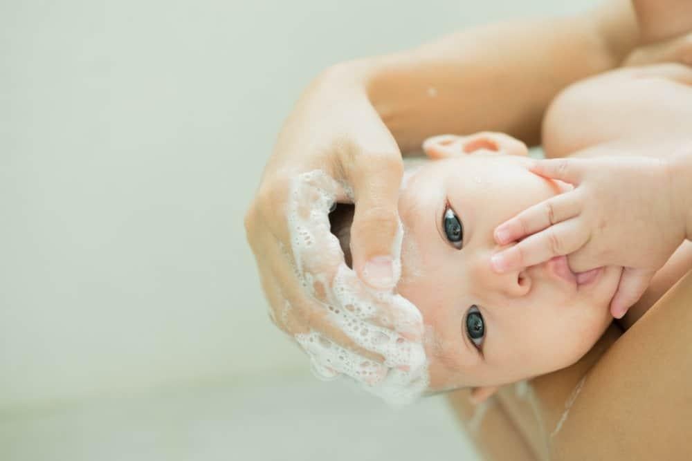 lông mày trẻ sơ sinh có vảy