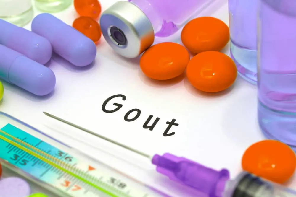 chẩn đoán và điều trị gout cấp