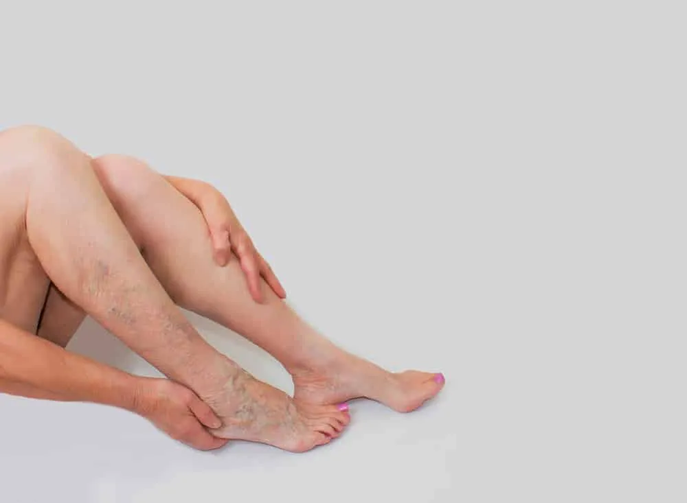 gối gác chân cho người giãn tĩnh mạch