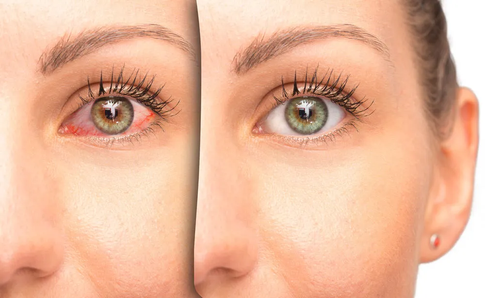 Cách dùng thuốc eyemiru 40 