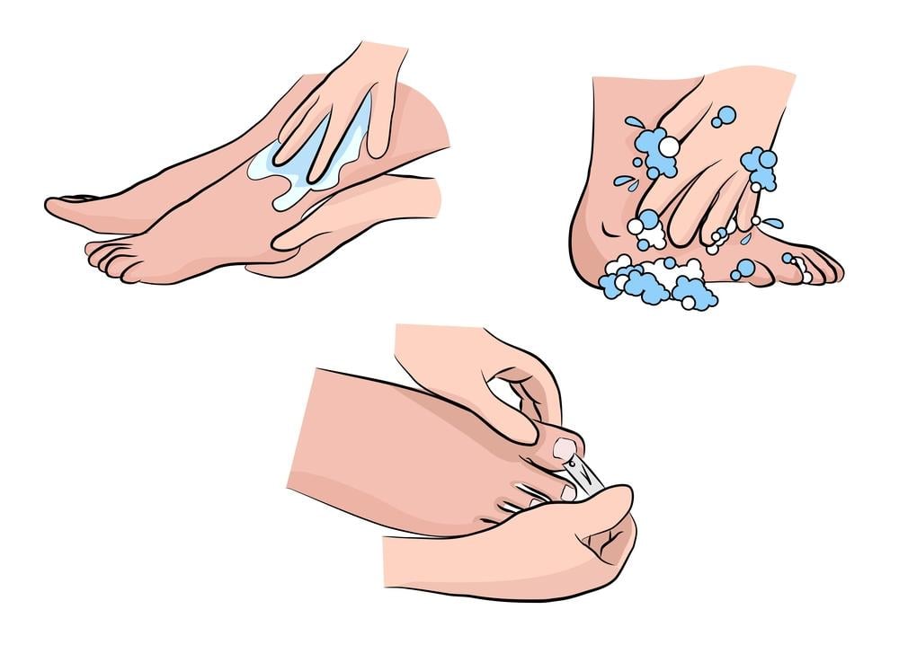 chăm sóc da của người bị tiểu đường