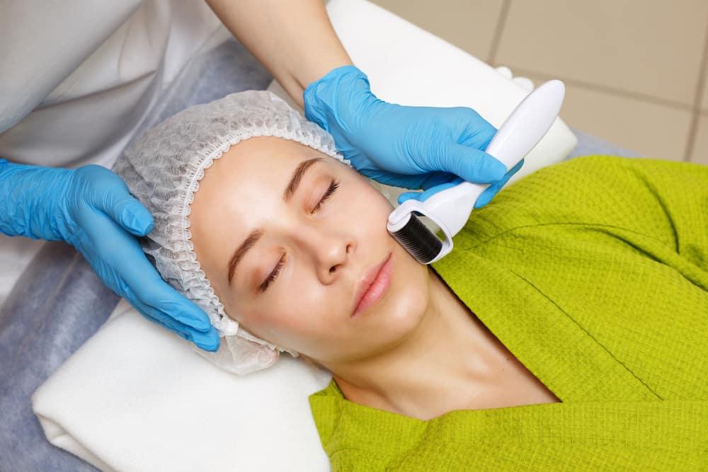 lưu ý khi lăn kim trị nám