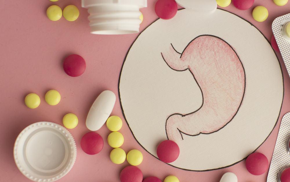 thuốc chữa viêm loét dạ dày