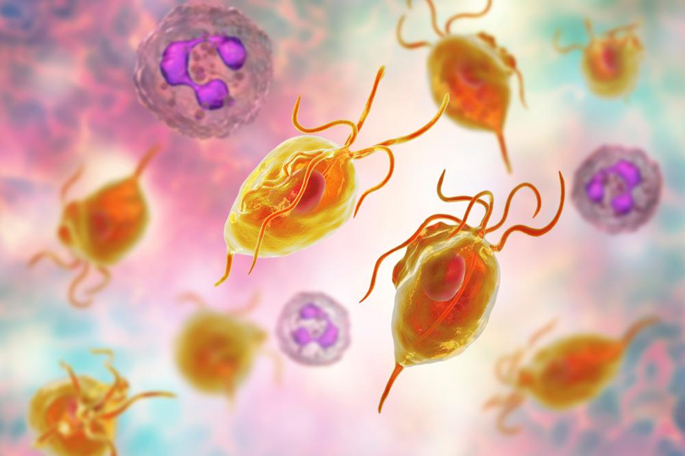 tinh dịch có mùi hôi do nhiễm trùng trichomonas