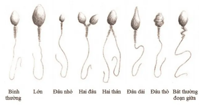 tinh trùng dị dạng có ảnh hưởng đến thai nhi không