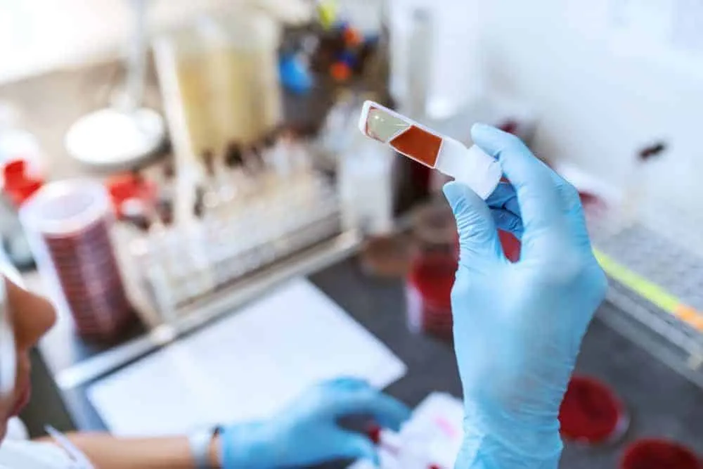 nguyên nhân ung thư máu là do đâu?