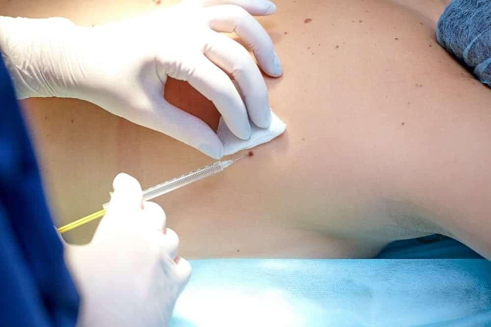 tiên lượng cho bệnh nhân ung thư da giai đoạn cuối