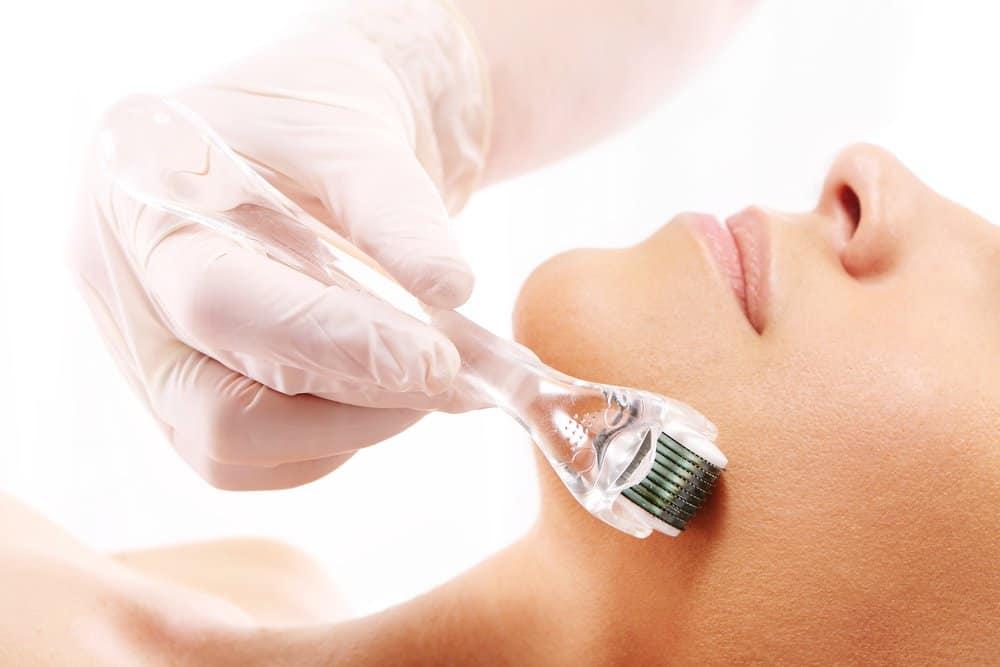 chăm sóc da sau lăn kim