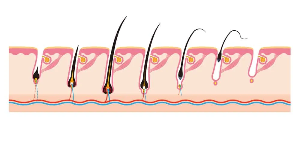 Triệt lông vĩnh viễn