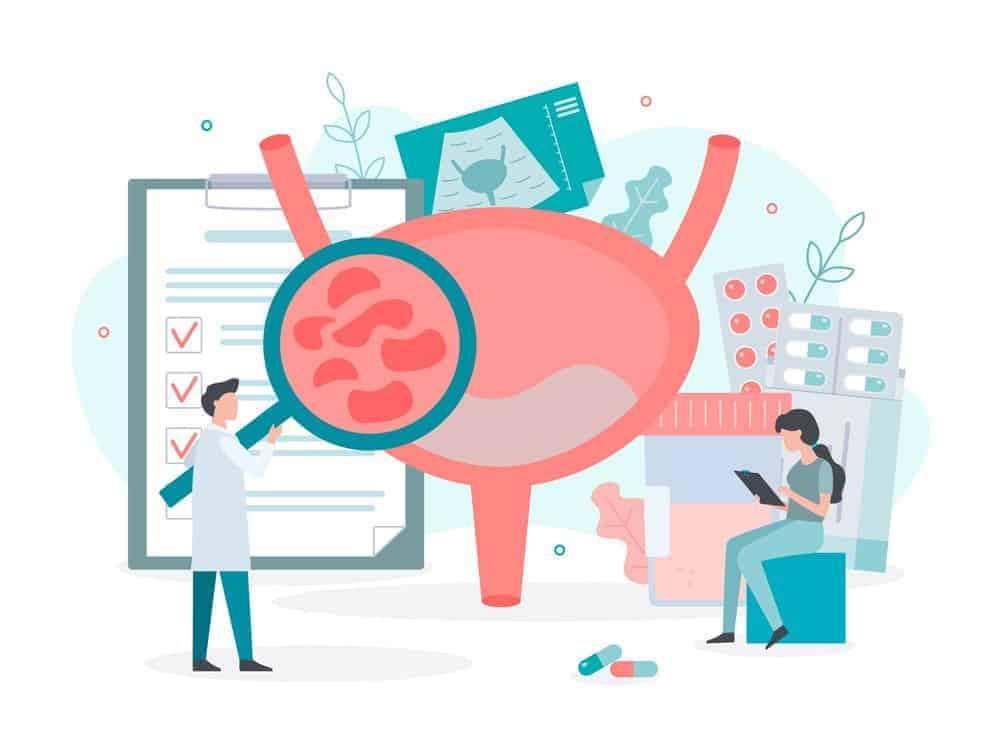 Ung thư bàng quang giai đoạn đầu