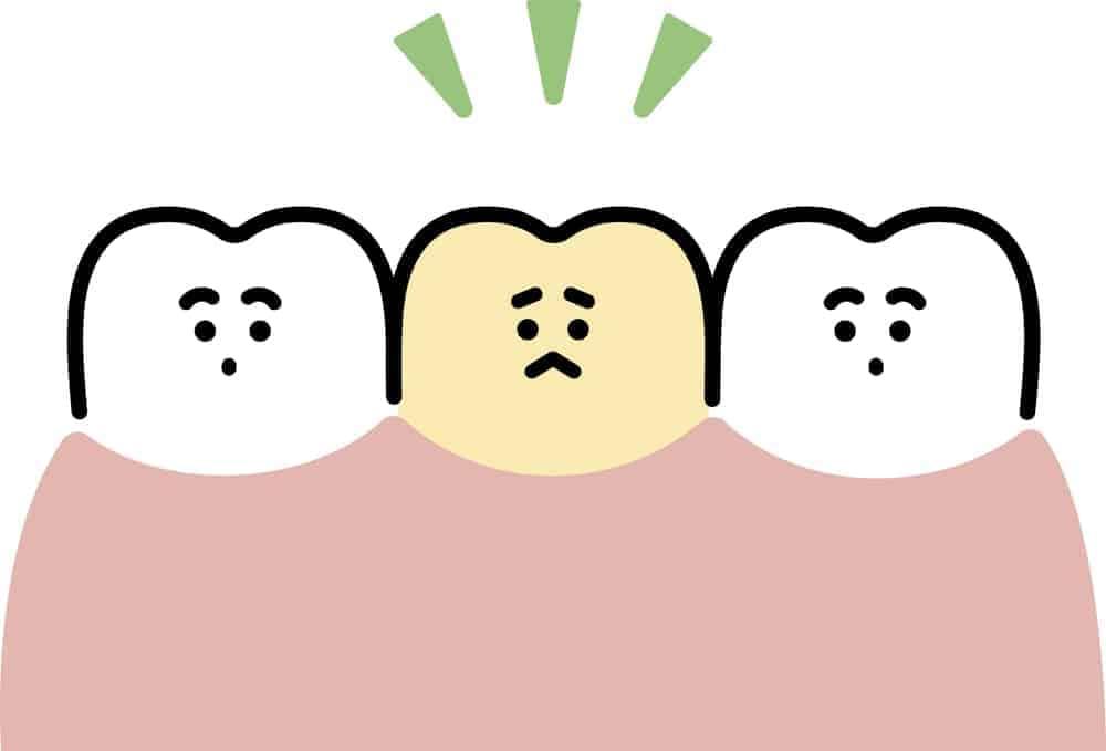 bút tẩy trắng răng