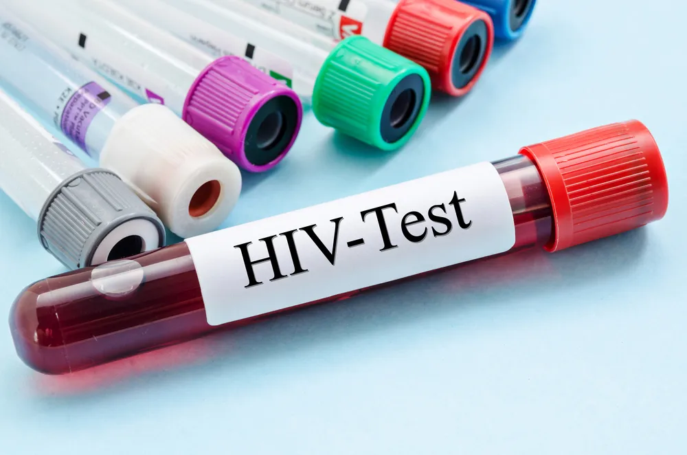 nhiễm HIV bao lâu thì phát bệnh