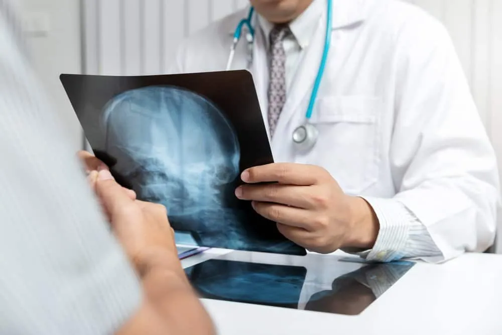 ung thư di căn não sống được bao lâu?