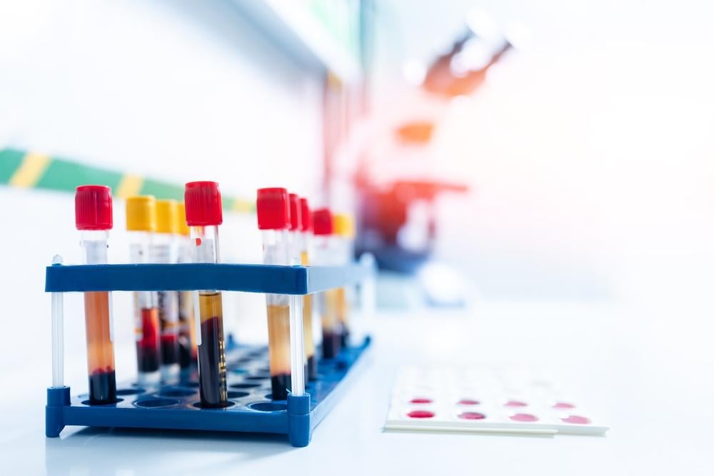 xét nghiệm HPV dương tính có nguy hiểm không