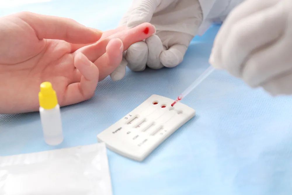 dấu hiệu nhiễm hiv sau 1 năm