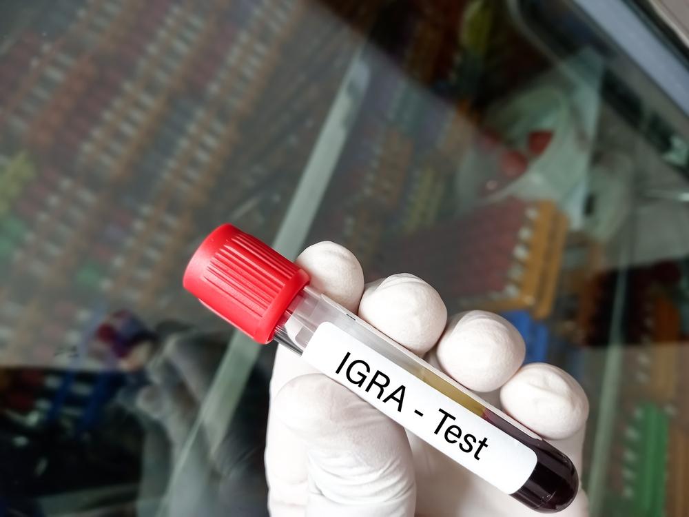 xét nghiệm lao qua máu