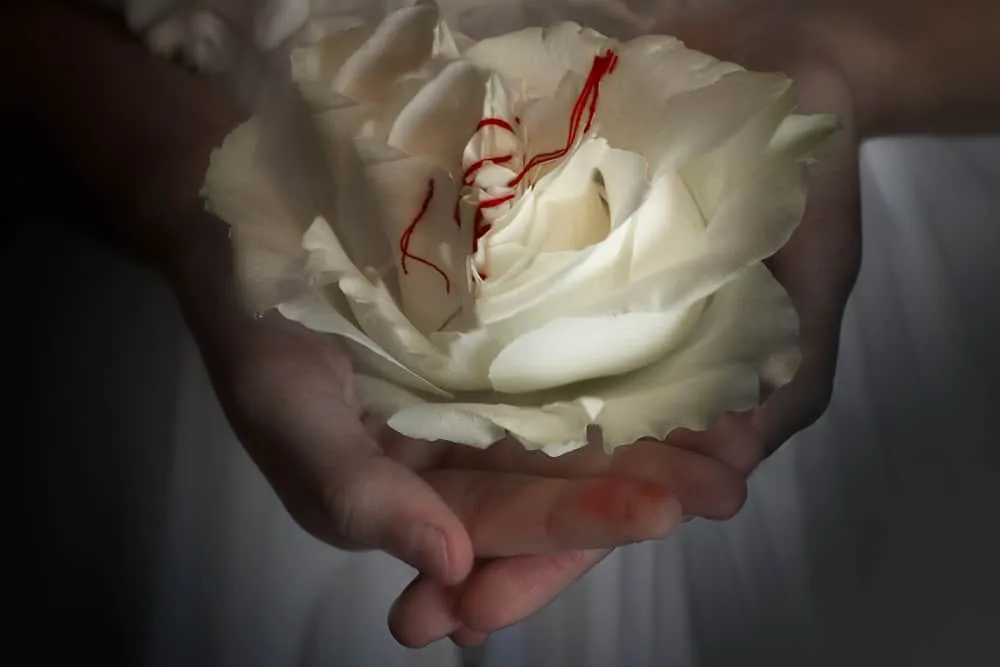 sau khi cắt bao quy đầu