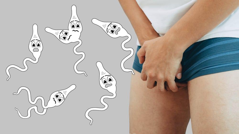 đầu khấc là gì