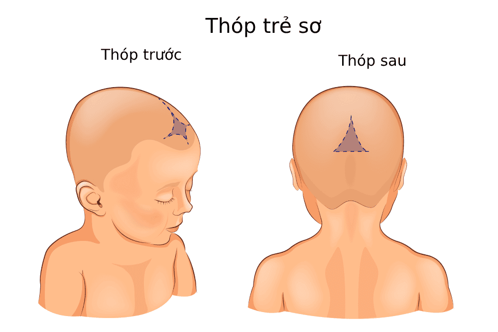 Phân biệt thóp trước và thóp sau