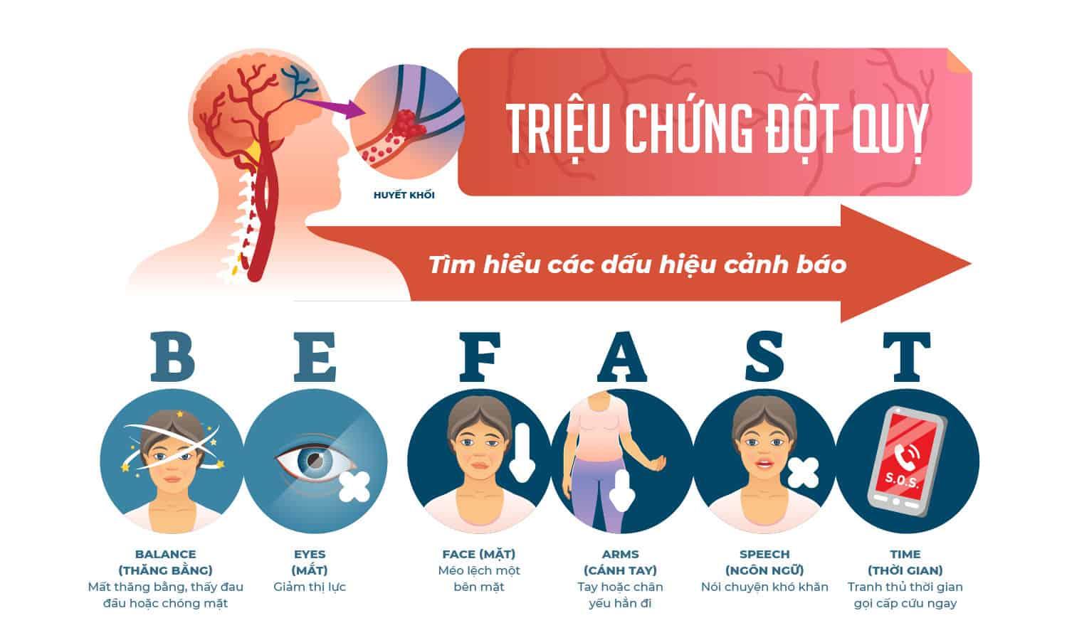 triệu chứng tai biến mạch máu não