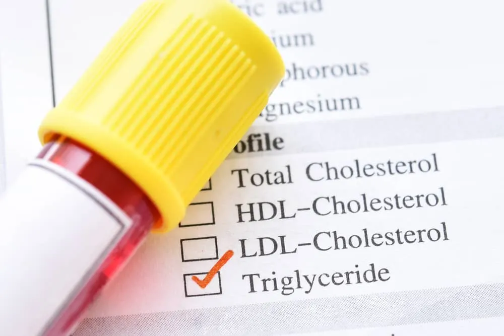 các chỉ số mỡ máu bạn cần biết