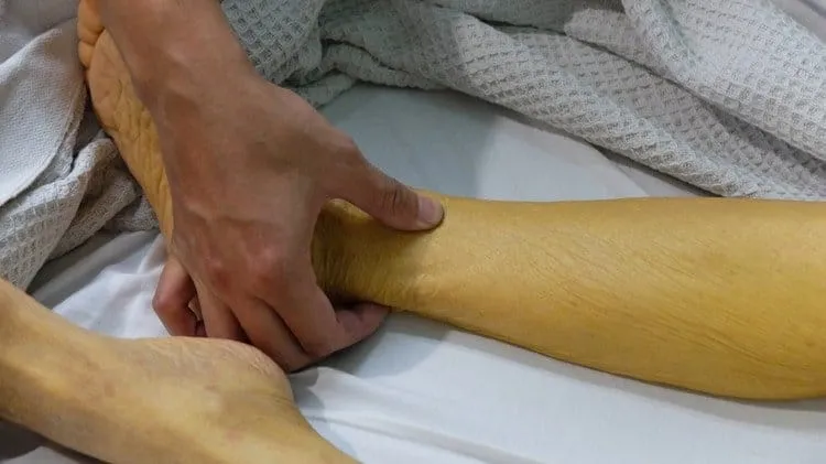 da bị vàng là thiếu chất gì