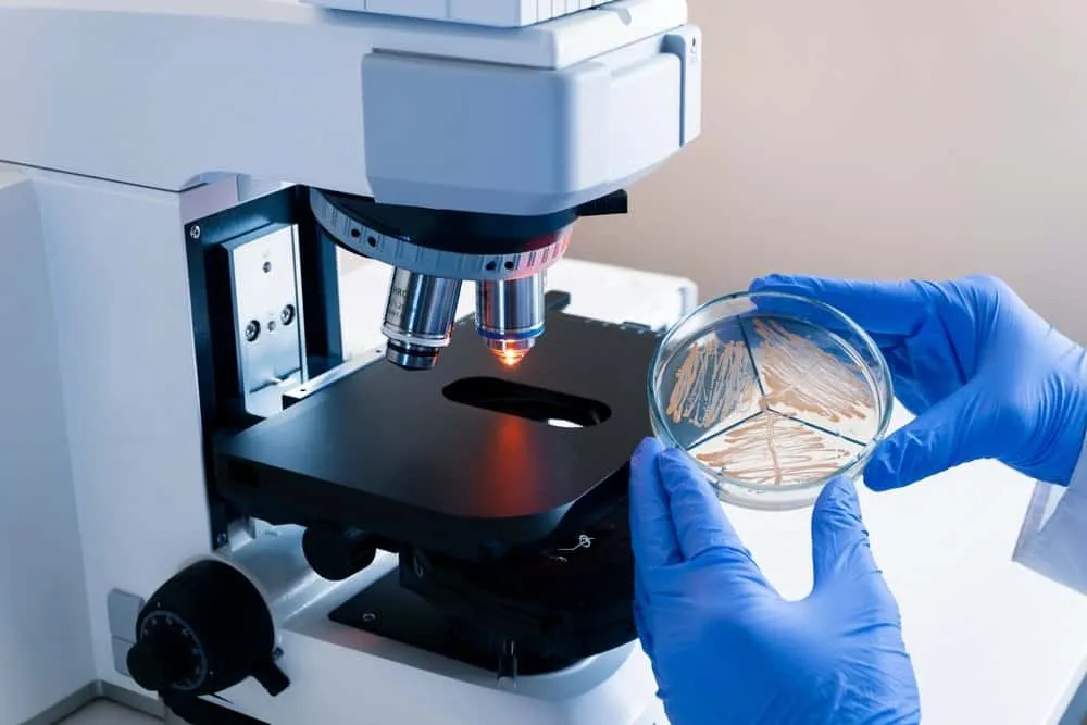 Chẩn đoán nhiễm liên cầu khuẩn nhóm B