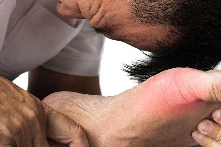 nguyên nhân gây bệnh gút