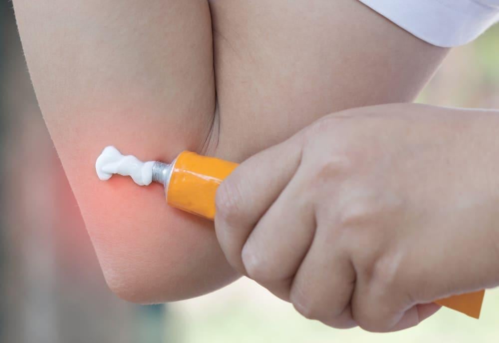 thuốc bôi ngoài da