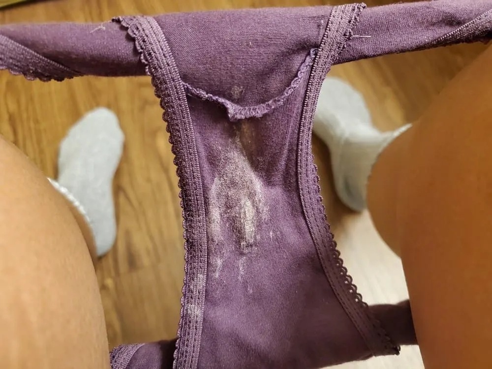 Vùng kín bị ngứa và có dịch trắng vón cục như bã đậu