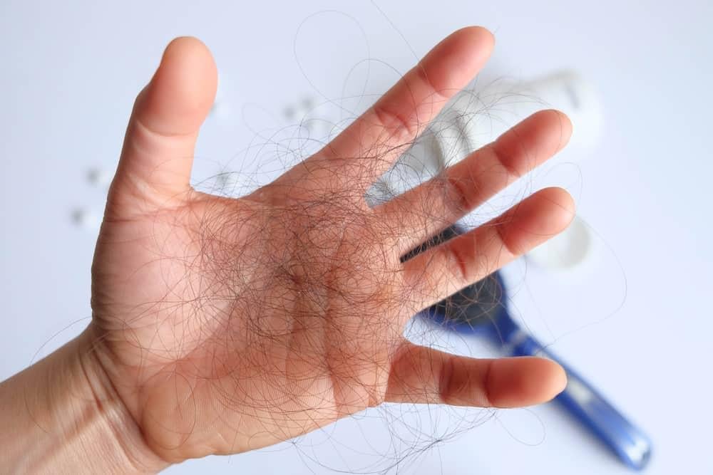 Rụng tóc thiếu chất gì - Chất sắt