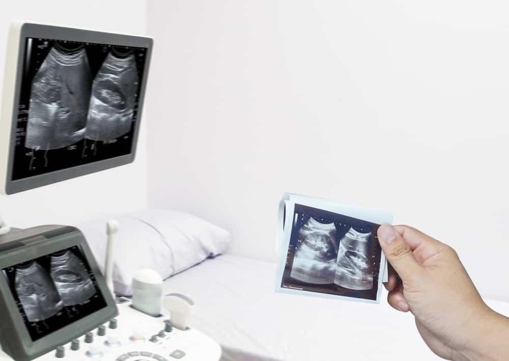 sau khi siêu âm dạ dày