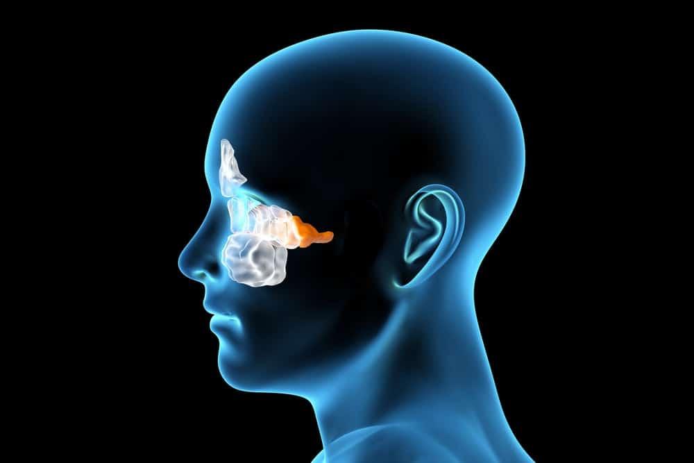 triệu chứng viêm xoang bướm