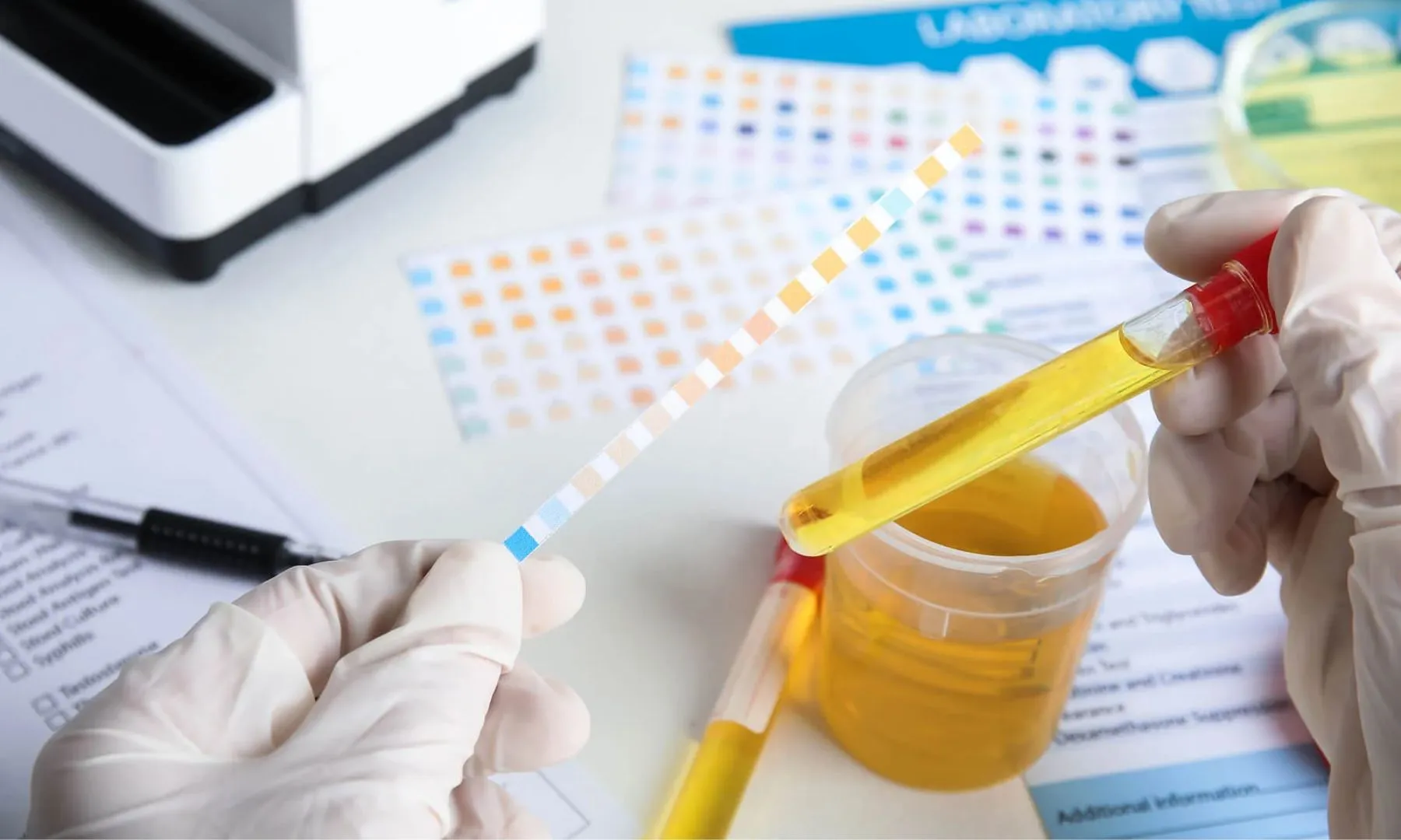 điều trị tiểu rắt tiểu buốt ở nữ