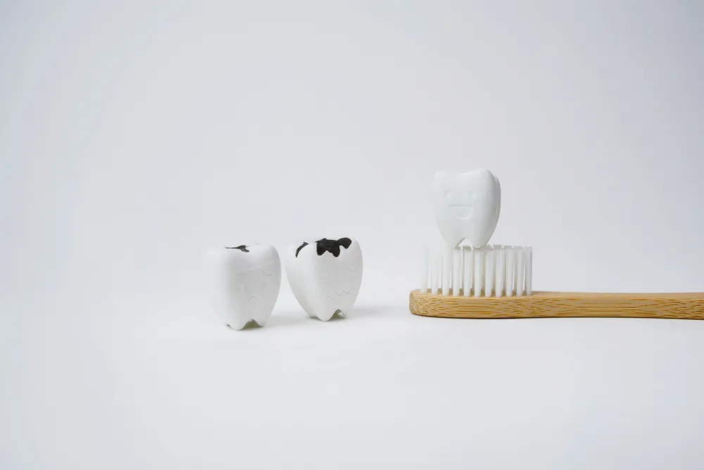 răng bé bị đen do vệ sinh răng miệng kém