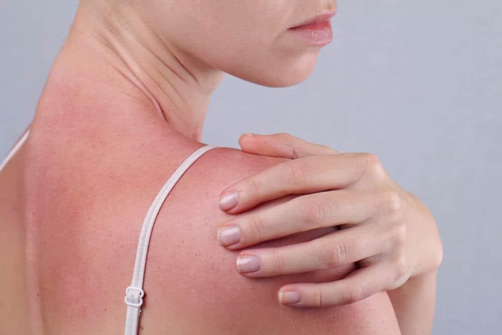 Triệu chứng phát ban HIV