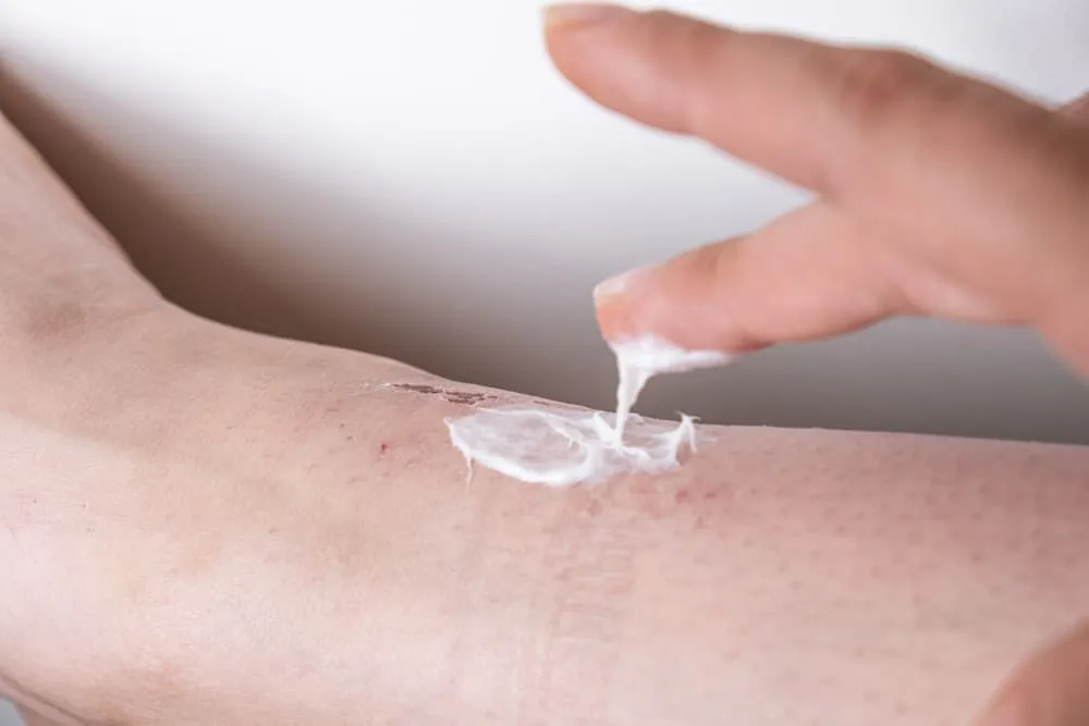 Thuốc trị ghẻ Elimite