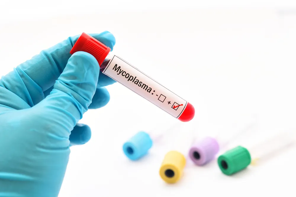 chẩn đoán trẻ bị viêm phổi do mycoplasma