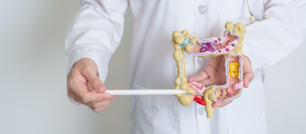 nguyên nhân viêm túi thừa manh tràng