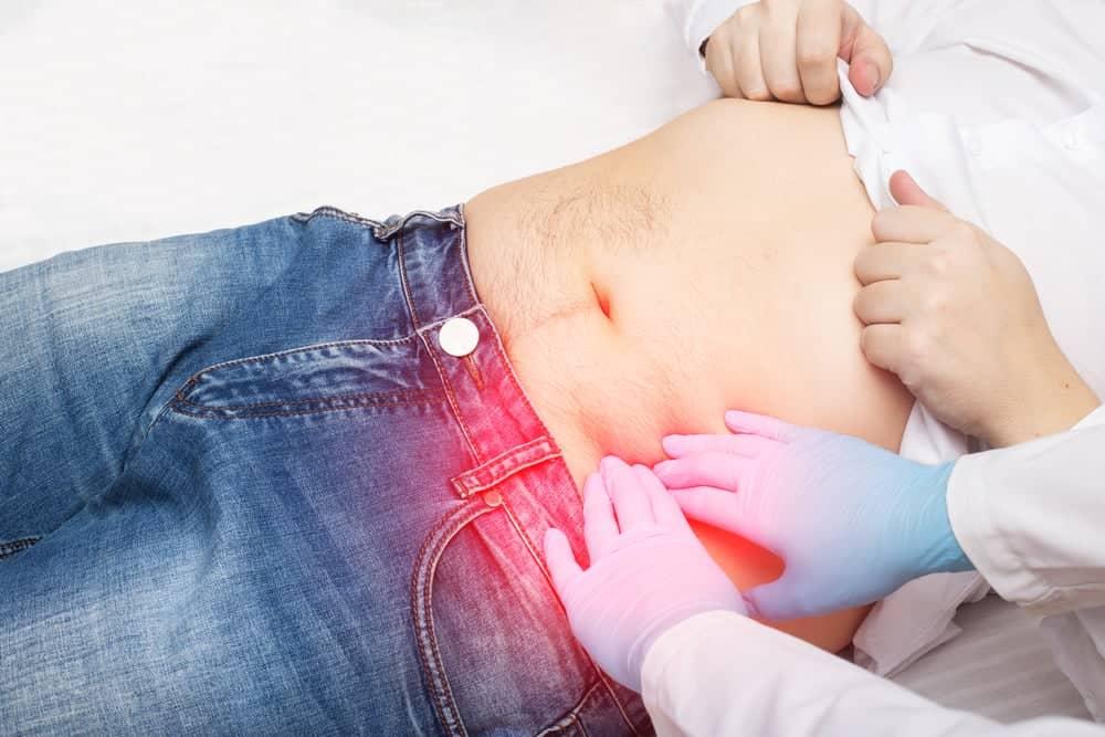 chẩn đoán viêm túi thừa