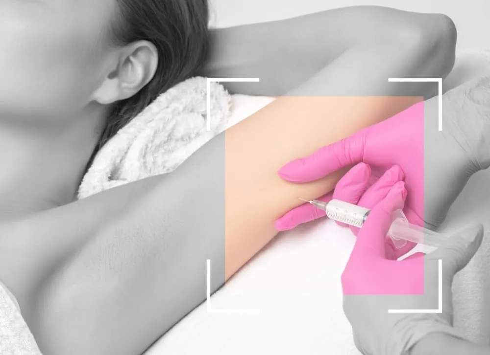 Cách tiêm dưới da