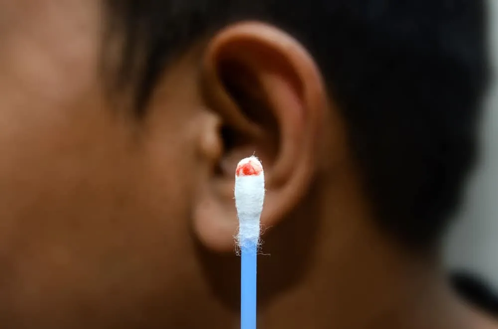 lấy ráy tai bị chảy máu có sao không