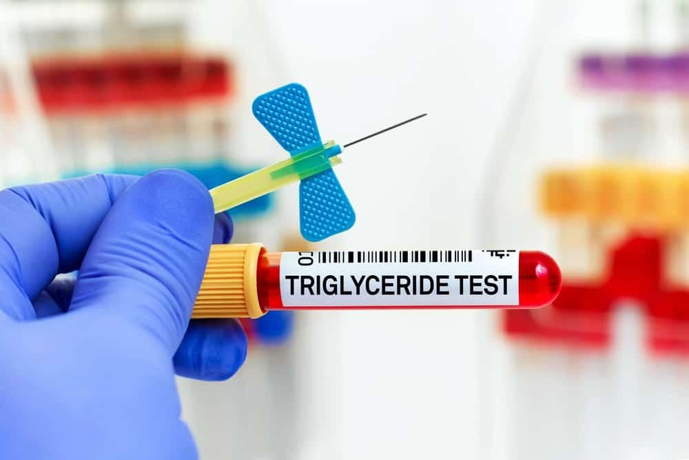 quy trình định lượng triglycerid