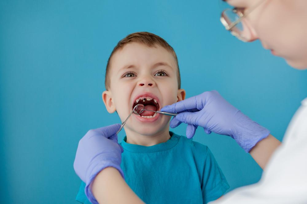 chẩn đoán răng mọc thừa