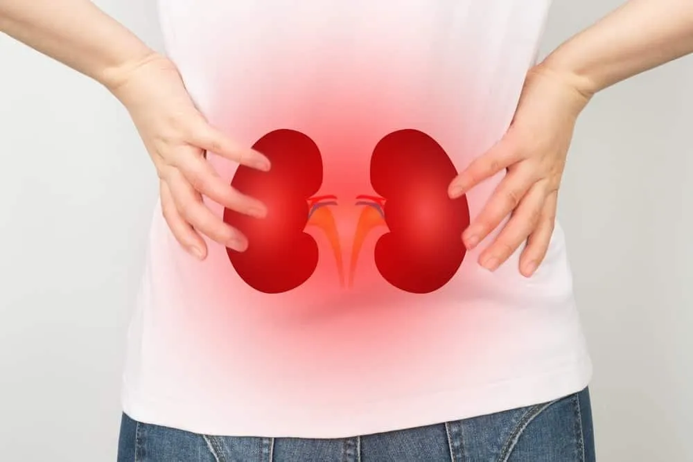 tán sỏi thận qua da có nguy hiểm không