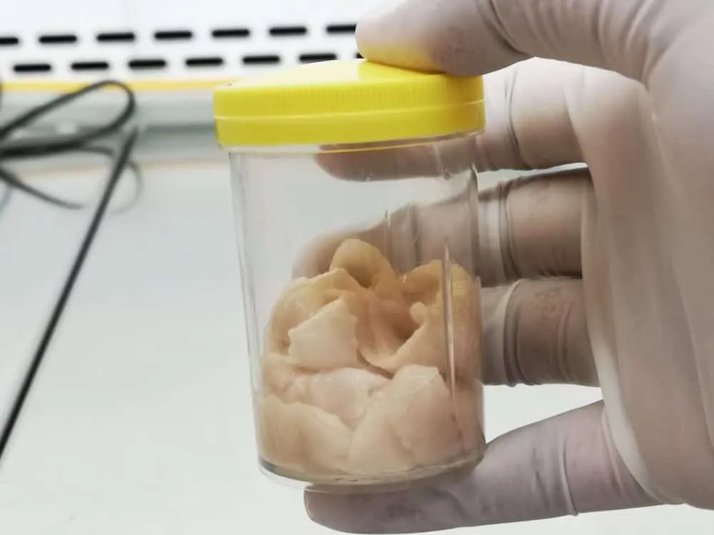 điều trị nhiễm sán dây bò