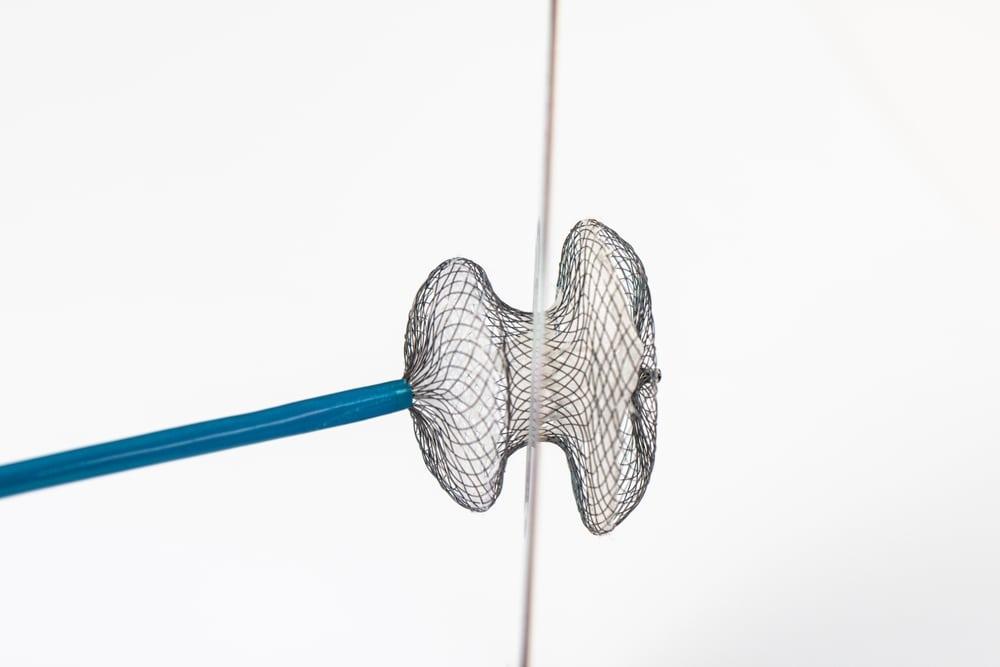 điều trị tứ chứng fallot