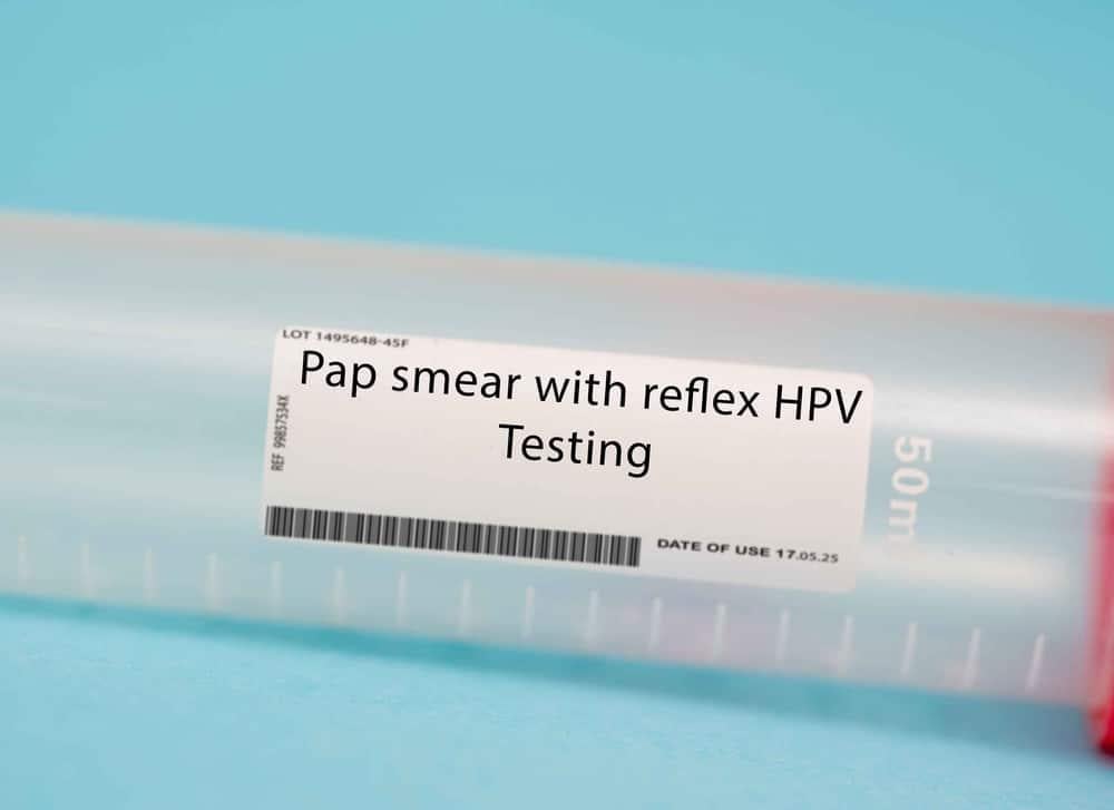 Virus HPV là gì