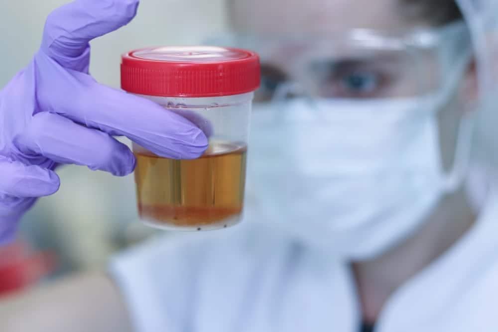 Tiểu rắt buốt ra máu ở nữ