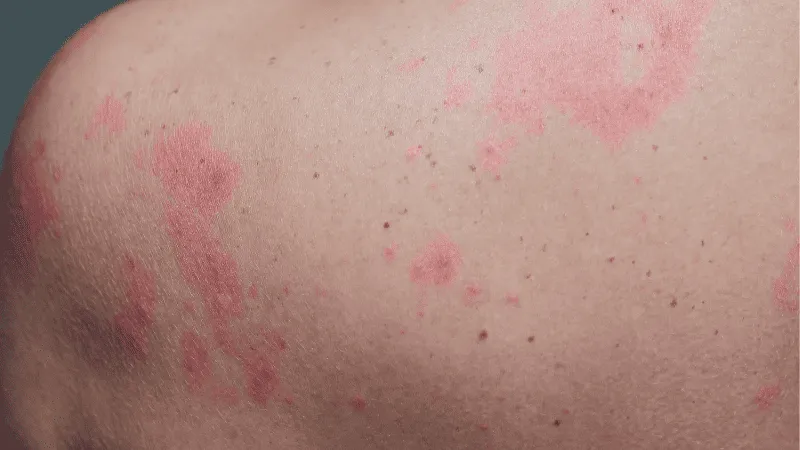 allopurinol stella 300mg